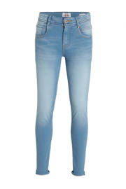 thumbnail: Light blue denim jongens Vingino skinny jeans Alex van stretchdenim met regular waist, rits- en knoopsluiting en effen