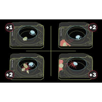 thumbnail: Beyblade X Xtreme Battle-set