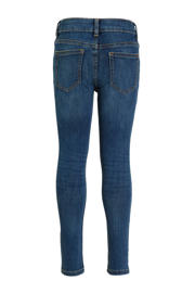 thumbnail: Blauw en zwarte jongens anytime skinny jeans zwarte van denim met rits- en knoopsluiting en effen