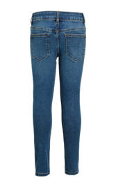 thumbnail: Medium blue denim jongens anytime skinny jeans medium van stretchdenim met rits- en knoopsluiting en effen